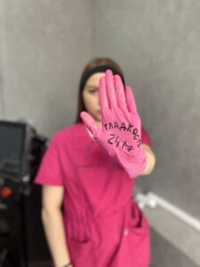 Лазерная эпиляция